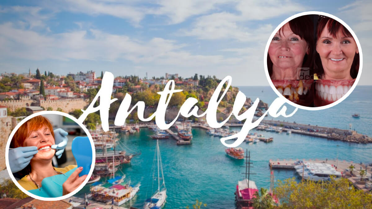 Budget-Friendly Dental Implant Treatment – Bonus Mediterranean Vacation