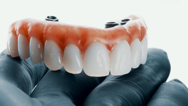 Hybrid Prosthesis: Frequently Asked Questions