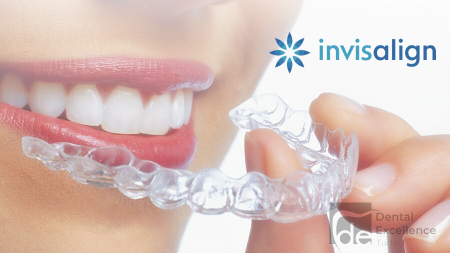 Invisalign Treatment in Turkey