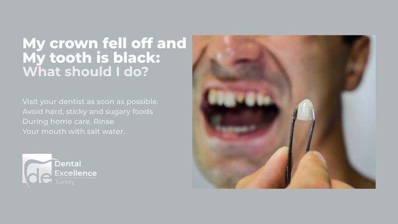 My Crown Fell Off and My Tooth is Black: What Should I Do?