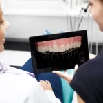 implant-operation
