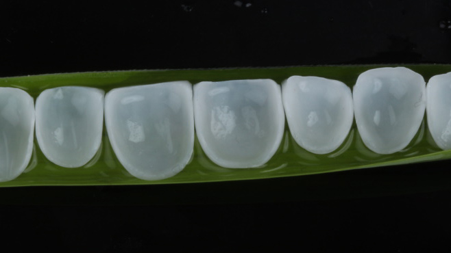 What E.MAX and Zirconia Crowns Are?