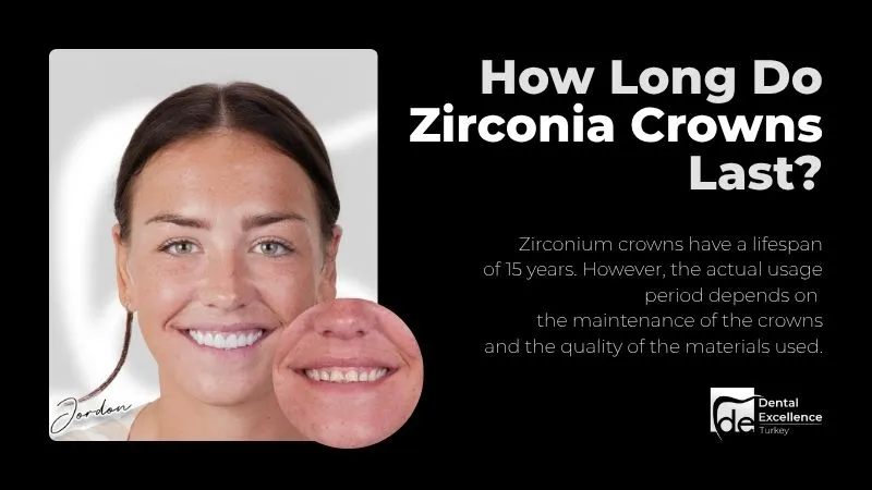 How Long Do Zirconia Crowns Last?