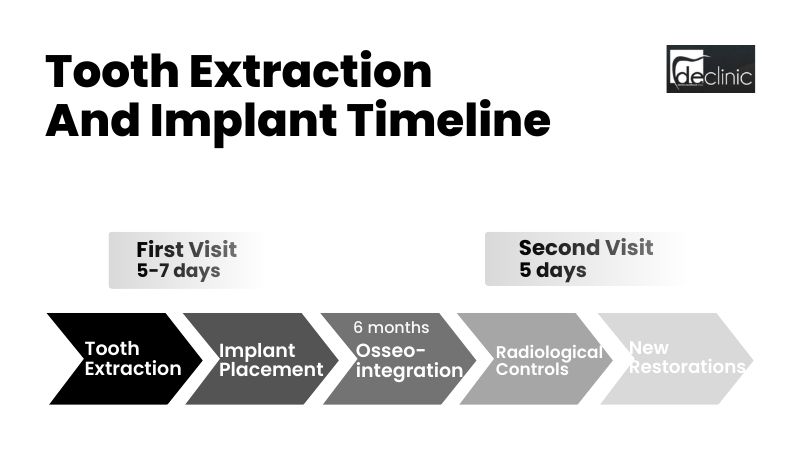 How To Plan The Tooth Extraction And Implant Timeline