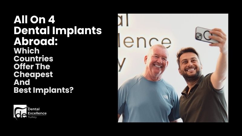 All On 4 Dental Implants Abroad: Cheapest Countries