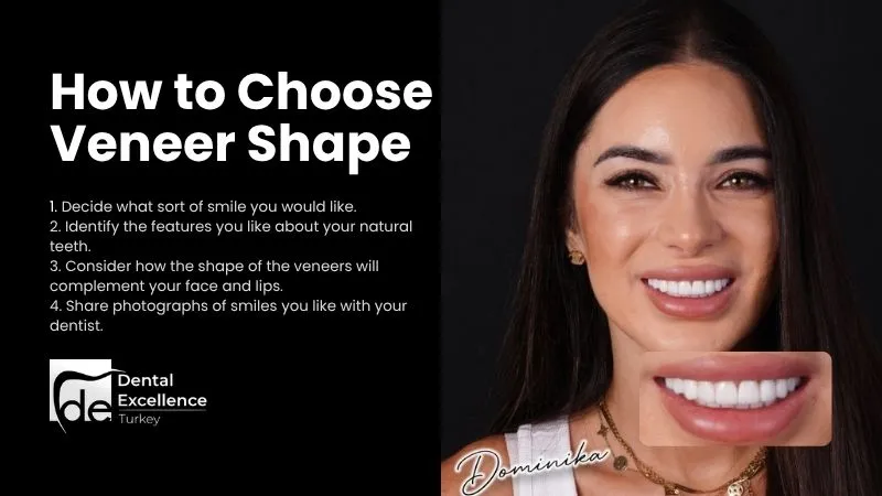 How to choose veneer shape