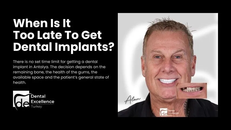 When is it too late to get dental implants? | Antalya