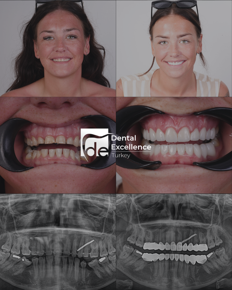 Before After Treatment
