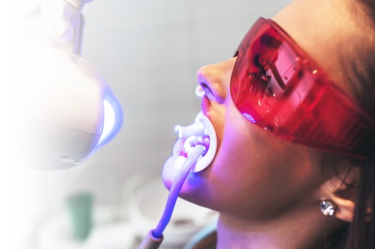 Teeth Whitening Dental Excellence Turkey Dental Clinic in Antalya